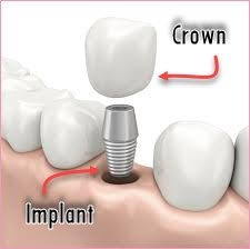 Modern Dental Treatment (2)