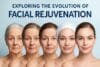 Graphic representation of facial rejuvenation's evolution, featuring historical and modern approaches to enhancing appearance.