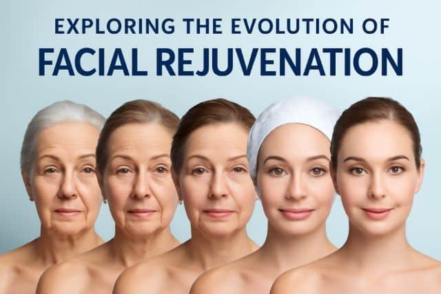 Graphic representation of facial rejuvenation's evolution, featuring historical and modern approaches to enhancing appearance.