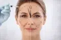 How Long Does Botox Last on the face and forehead after treatment