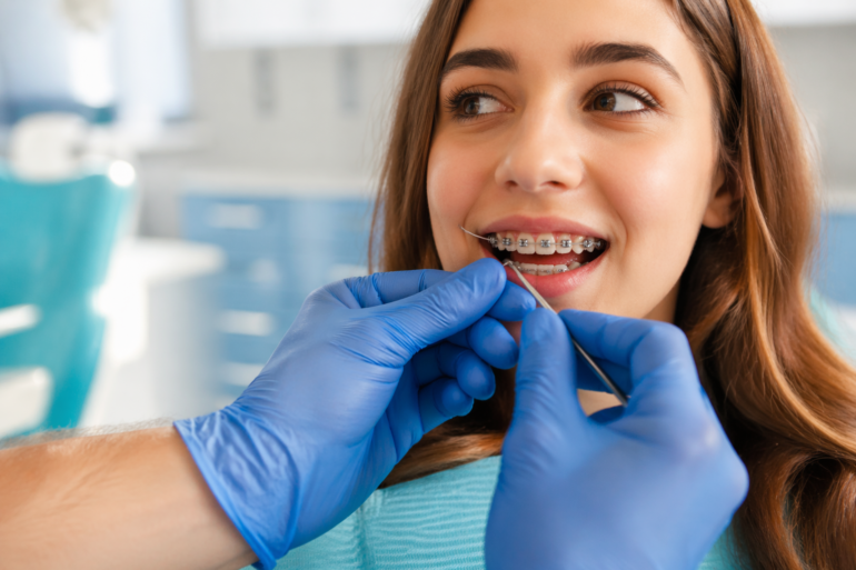 Orthodontic patient wearing Power Chain Braces to close gaps and improve tooth alignment