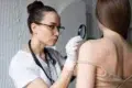 A focused female doctor in a white coat and gloves examines a mole on a patient's back using a magnifying glass, in a clinical setting.