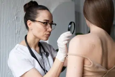 A focused female doctor in a white coat and gloves examines a mole on a patient's back using a magnifying glass, in a clinical setting.