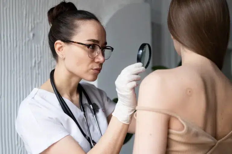 A focused female doctor in a white coat and gloves examines a mole on a patient's back using a magnifying glass, in a clinical setting.