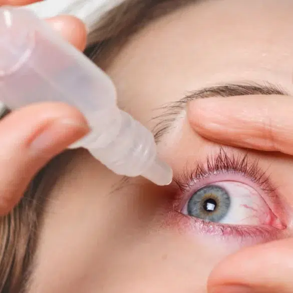 Close-up of a person applying eye drops to an irritated blue eye with visible redness. The hand gently holds the eyelid open, conveying caution and care.