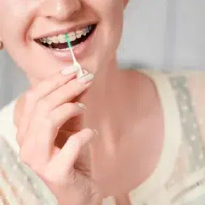 A person smiles while using an interdental brush to clean their braces. The background is soft and neutral, emphasizing dental hygiene and care.