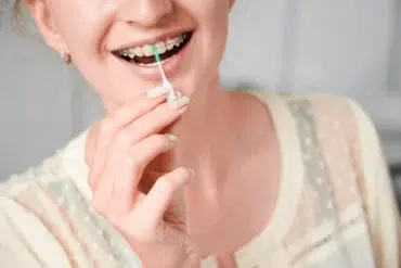 A person smiles while using an interdental brush to clean their braces. The background is soft and neutral, emphasizing dental hygiene and care.