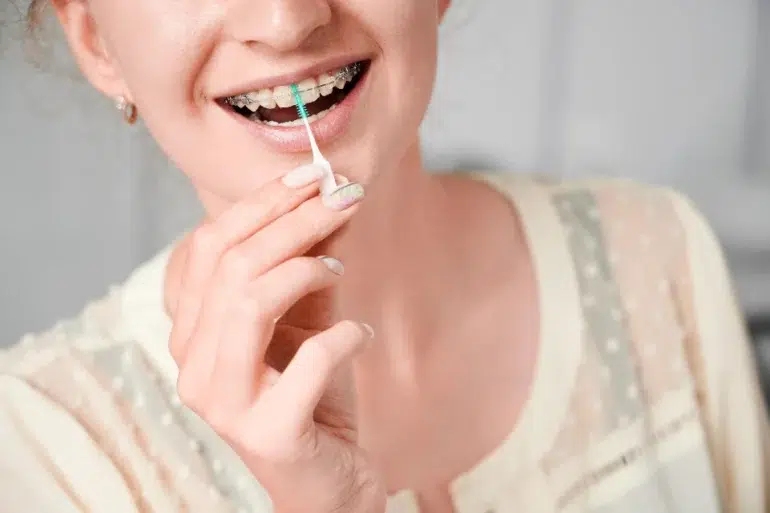 A person smiles while using an interdental brush to clean their braces. The background is soft and neutral, emphasizing dental hygiene and care.