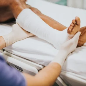 A person in medical gloves adjusts a white cast on a patient's leg and foot.