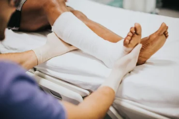 A person in medical gloves adjusts a white cast on a patient's leg and foot.